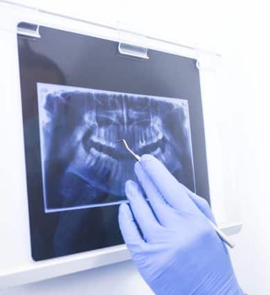 cirugia-oral-dental-coruña