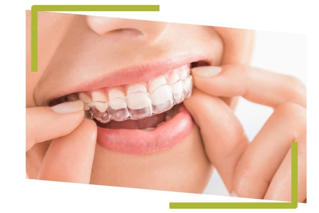 ortodoncia-invisible-erwin-dental