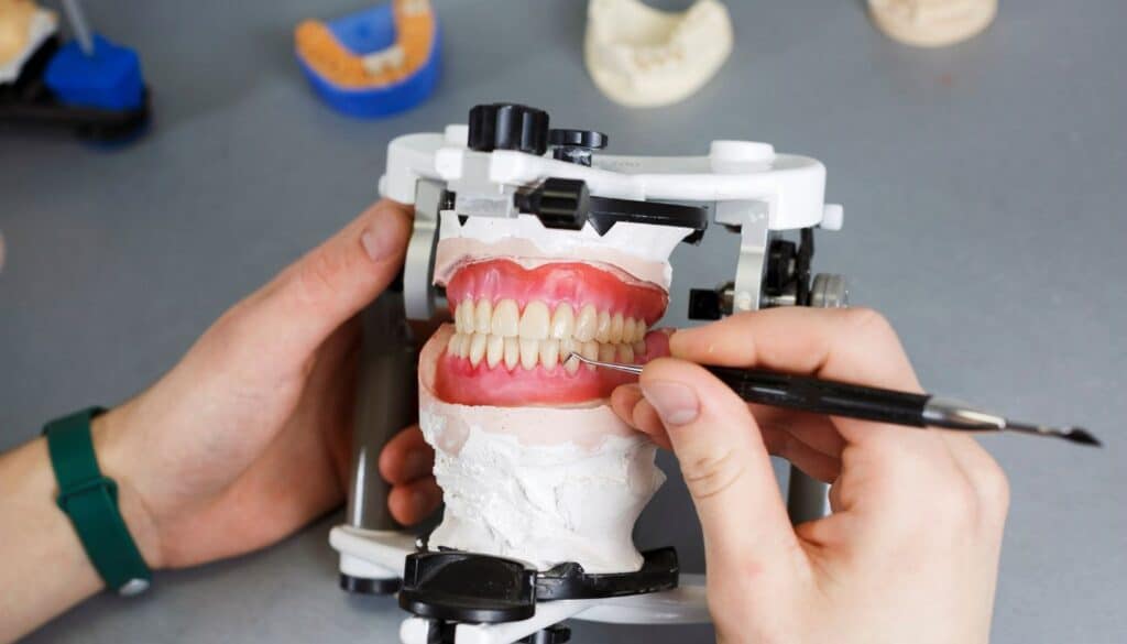 protesis-dentales-erwin