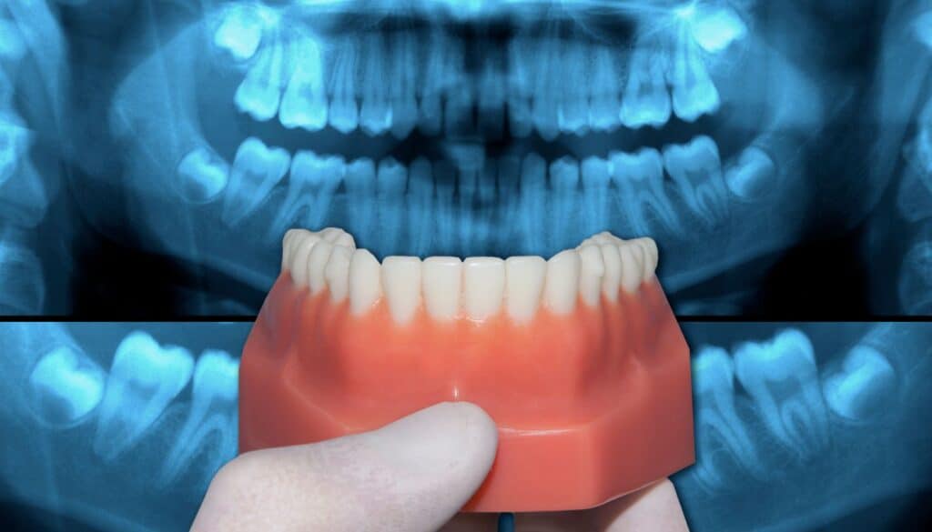 ejemplo de una buena oclusion dental